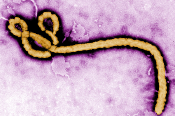 Top 5 Stories Of The Day | NCDC says Nigeria Is Not Fully Ready For An Ebola Outbreak